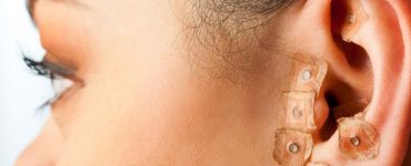 auriculoterapia