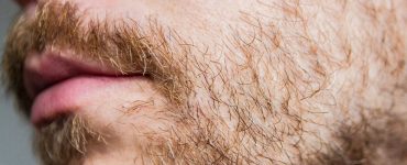 É normal não ter barba?